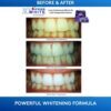 before and after crest whitening strips