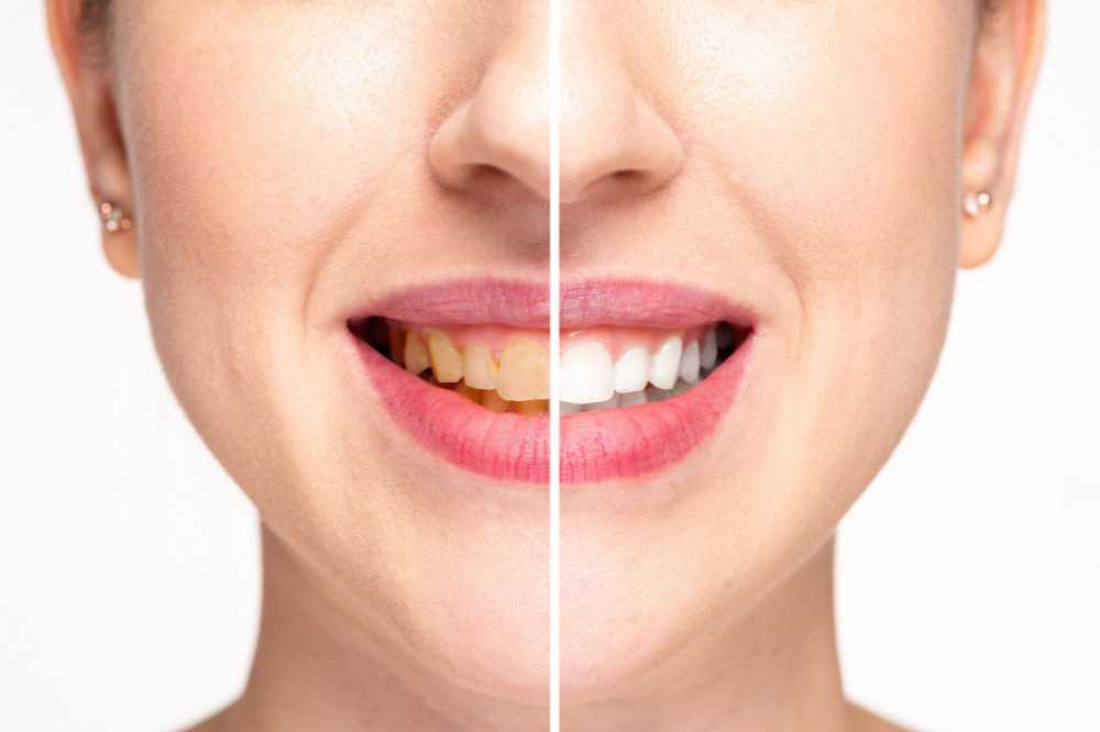 what makes teeth yellow